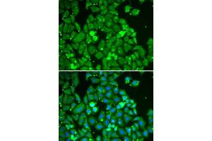 Immunofluorescence (IF) image for anti-Signal Transducer and Activator of Transcription 1, 91kDa (STAT1) (AA 513-712) antibody (ABIN6213588) (STAT1 antibody  (AA 513-712))