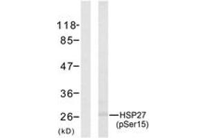 Western blot analysis of extracts from HeLa cells treated with UV, using HSP27 (Phospho-Ser15) Antibody. (HSP27 antibody  (pSer15))