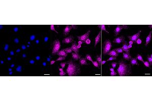 anti-Zinc Finger Protein GLI1 (GLI1) antibody