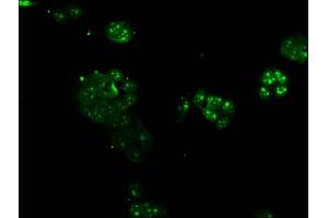 Immunofluorescence staining of PC-3 cells with ABIN7144653 at 1:166, counter-stained with DAPI. (ARNTL antibody  (AA 366-585))