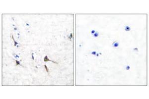 Immunohistochemical analysis of paraffin-embedded human brain tissue using Potassium Channel Kv3. (Kv3.2b Potassium Channel antibody  (C-Term))