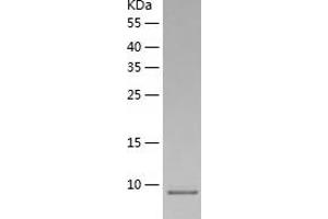 Western Blotting (WB) image for Chemokine (C-C Motif) Ligand 16 (CCL16) (AA 24-120) protein (His tag) (ABIN7284383) (CCL16 Protein (AA 24-120) (His tag))