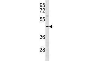 TXNIP antibody western blot analysis in NCI-H292 lysate. (TXNIP antibody  (AA 1-30))