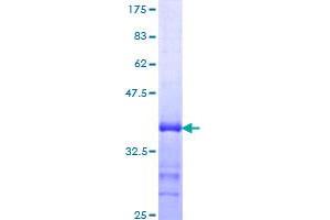 GFI1 Protein (AA 1-91) (GST tag)