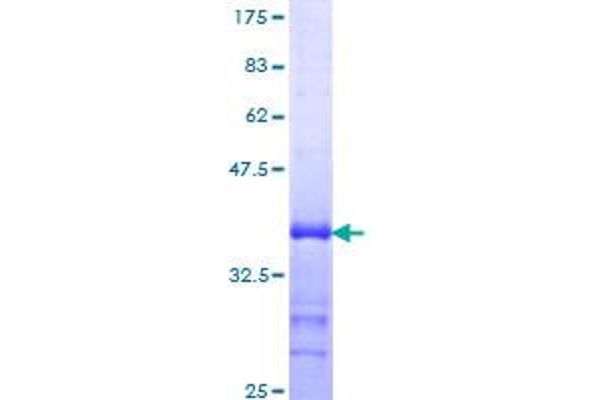 GFI1 Protein (AA 1-91) (GST tag)