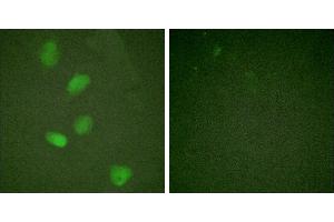 TNF-a - +Immunofluorescence analysis of HeLa cells, treated with TNF-a (20nM, 15mins), using HDAC3 (Ab-424) antibody. (HDAC3 antibody)