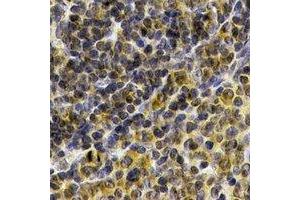 Immunohistochemical analysis of IL-21 staining in human spleen  formalin fixed paraffin embedded tissue section. (IL-21 antibody)