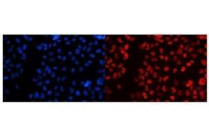 IF analysis of splicing factor 1 using anti-splicing factor 1 antibody (ABIN5692946). (Splicing Factor 1 antibody  (AA 160-266))
