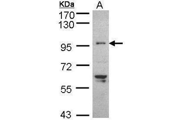 TNNI3K antibody