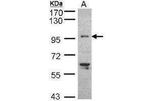 WB Image Sample (30 ug of whole cell lysate) A: HeLaS3 7. (TNNI3K antibody)