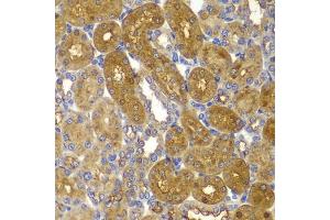 Immunohistochemistry of paraffin-embedded rat kidney using AMPKβ1 antibody (ABIN6134216, ABIN6146175, ABIN6146177 and ABIN6223916) at dilution of 1:100 (40x lens). (PRKAB1 antibody)