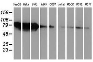 Image no. 2 for anti-Zinc Finger Protein 36, C3H Type, Homolog (Mouse) (ZFP36) antibody (ABIN1501406)