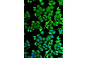 Immunofluorescence analysis of A549 cells using NAA50 antibody. (NAA50 antibody  (AA 1-169))
