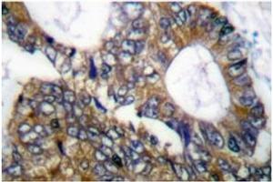 Image no. 1 for anti-Heat Shock 105kDa/110kDa Protein 1 (HSPH1) antibody (ABIN265469) (HSPH1 antibody)