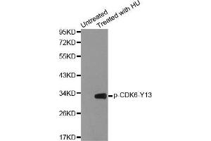 Western blot analysis of extracts from 293 cells using Phospho-CDK6-Y13 antibody.