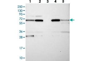 Western blot analysis of Lane 1: RT-4, Lane 2: U-251 MG, Lane 3: Human Plasma, Lane 4: Liver, Lane 5: Tonsil with CPEB4 polyclonal antibody  at 1:250-1:500 dilution. (CPEB4 antibody)