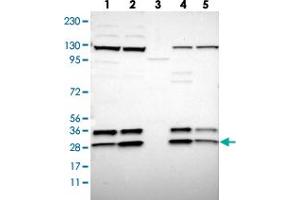 Western blot analysis of Lane 1: RT-4, Lane 2: U-251 MG, Lane 3: Human Plasma, Lane 4: Liver, Lane 5: Tonsil with SSR3 polyclonal antibody .