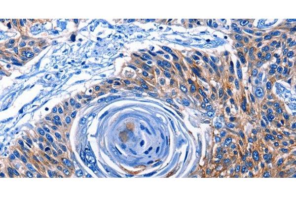 CLEC2B antibody
