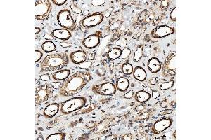 IHC analysis of SH2D4A using anti-SH2D4A antibody (ABIN7601695). (SH2D4A antibody  (AA 42-454))