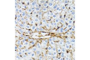 Immunohistochemistry of paraffin-embedded mouse liver using SERPING1 antibody (ABIN6290125) at dilution of 1:100 (40x lens). (SERPING1 antibody)