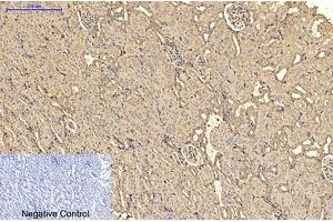 Immunohistochemical analysis of paraffin-embedded rat kidney tissue. (alpha-SMA antibody)