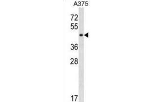 Western Blotting (WB) image for anti-SGT1, Suppressor of G2 Allele of SKP1 (SUGT1) antibody (ABIN3000456)