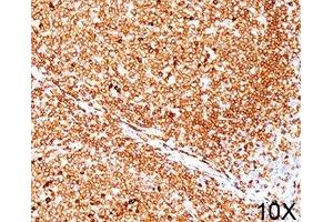 IHC testing of human tonsil (10X) stained with CD79a antibody (JCB117). (CD79a antibody  (AA 202-216))
