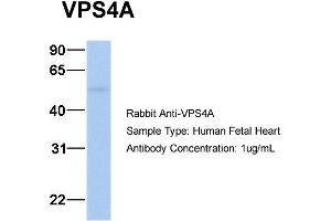 Host: Rabbit Target Name: VPS4A Sample Type: Human Fetal Heart Antibody Dilution: 1. (VPS4A antibody  (N-Term))