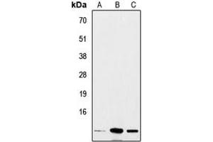 Western blot analysis of Insulin expression in A549 (A), mouse heart (B), rat liver (C) whole cell lysates. (Insulin antibody  (Center))