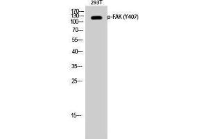 Western Blotting (WB) image for anti-PTK2 Protein tyrosine Kinase 2 (PTK2) (pTyr407) antibody (ABIN3182535) (FAK antibody  (pTyr407))