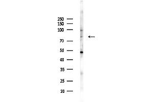 anti-Protein Phosphatase 1, Regulatory Subunit 13 Like (PPP1R13L) (C-Term) antibody