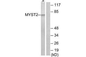 Western blot analysis of extracts from Jurkat cells, using MYST2 antibody. (MYST2 antibody  (Internal Region))
