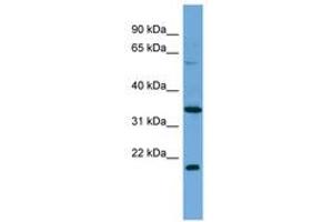 Image no. 1 for anti-Mesoderm Induction Early Response 1, Family Member 2 (MIER2) (C-Term) antibody (ABIN6745650) (MIER2 antibody  (C-Term))