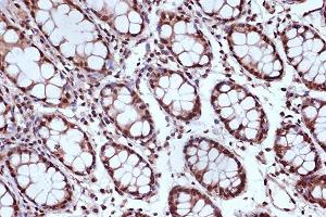 Immunohistochemistry of paraffin-embedded human colon using MSH2 Rabbit mAb (ABIN7268547) at dilution of 1:100 (40x lens).