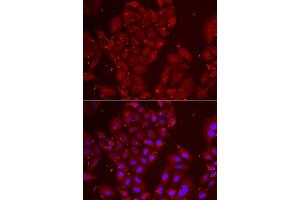 Immunofluorescence analysis of U2OS cells using TPP2 antibody. (Tpp2 antibody  (AA 1-300))