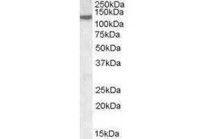 Image no. 1 for anti-Solute Carrier Family 12 (Potassium-Chloride Transporter) Member 6 (SLC12A6) (Internal Region) antibody (ABIN374883) (SLC12A6 antibody  (Internal Region))