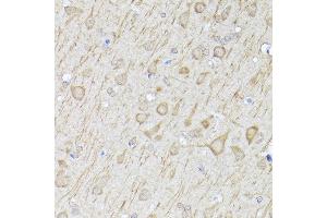 Immunohistochemistry of paraffin-embedded rat brain using [KO Validated] LC3B Rabbit pAb (ABIN6134220, ABIN6143470, ABIN6143475 and ABIN6215146) at dilution of 1:100 (40x lens). (LC3B antibody  (AA 1-100))