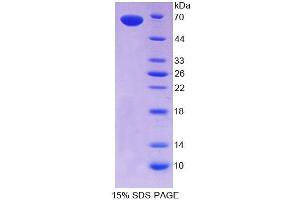 SDS-PAGE analysis of Human CLEC11A Protein. (CLEC11A Protein)