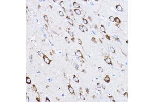 Immunohistochemistry of paraffin-embedded rat brain using RPL8 Rabbit pAb (ABIN6128659, ABIN6147155, ABIN6147156 and ABIN6214154) at dilution of 1:50 (40x lens). (RPL8 antibody  (AA 1-257))