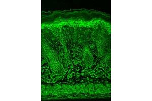 Immunohistochemistry analysis using Mouse Anti-HIF1 alpha Monoclonal Antibody, Clone ESEE122 . (HIF1A antibody  (AA 329-530) (PE))