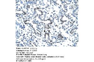 Human Lung (EVX1 antibody  (N-Term))