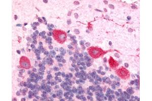 Anti-HCRTR1 / Orexin Receptor 1 antibody IHC of rat brain, Purkinje neurons. (HCRTR1 antibody  (Cytoplasmic Domain))