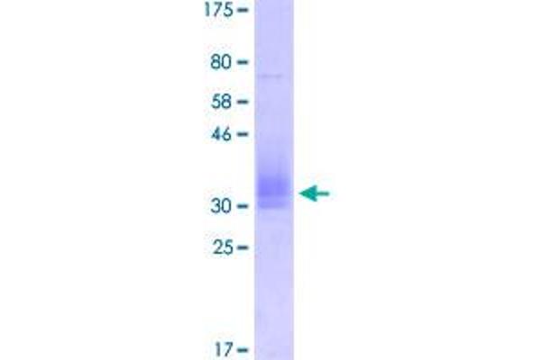 CD147 Protein (AA 22-207) (His-DYKDDDDK-Strep II Tag)