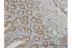Image no. 2 for anti-N-Myc (And STAT) Interactor (NMI) (AA 1-101) antibody (ABIN598595) (NMI antibody  (AA 1-101))