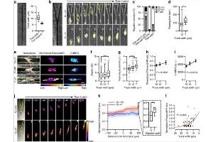 Spatial confinement influences migration decision-making, cellular ATP:ADP ratio, and glucose uptake. (Rat Tail)