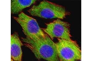 Fluorescent confocal image of C2C12 cell stained with AKT2 antibody at 1:25. (AKT2 antibody  (AA 452-481))
