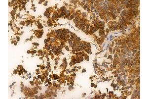 ABIN6262192 and ABIN6266561 at 1/100 staining human pituitary adenoma by IHC-P. (HDAC9 antibody  (C-Term))