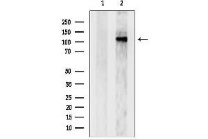 anti-DNA Replication Helicase 2 Homolog (DNA2) (Internal Region) antibody