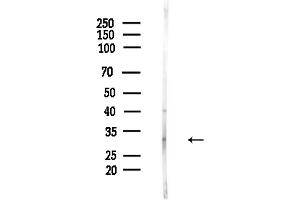 Western blot analysis of lysates from Hela cells(LPS,4h treatment), using Phospho-SNAIL (Ser11) Antibody at 1/1000 dilution.