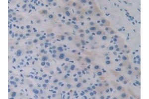 Immunohistochemistry (IHC) image for anti-Apolipoprotein A-V (APOA5) (AA 167-335) antibody (ABIN7434506)